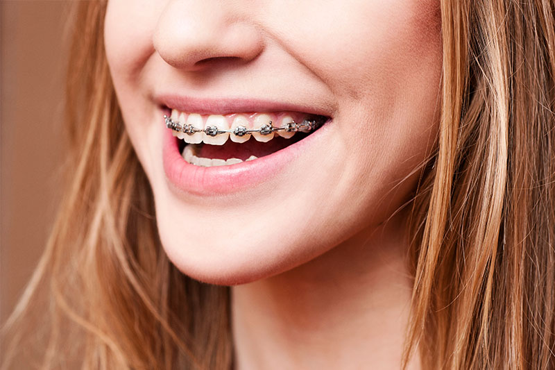 Orthodontics in Anaheim